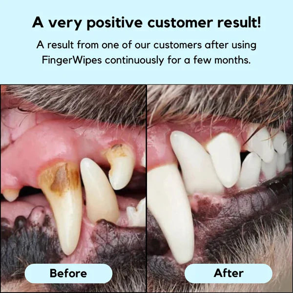 Fresh Wipes Kit – For Dental Diseases(50)pcs